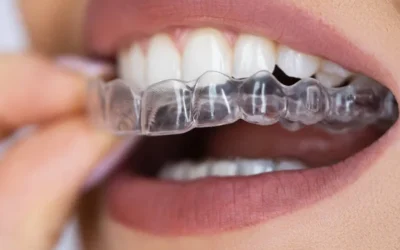 Blog 6 Dentist Near Me 77005 TX