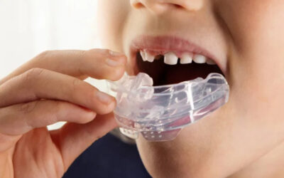 Blog 10 Dentist Near Me West University Place TX