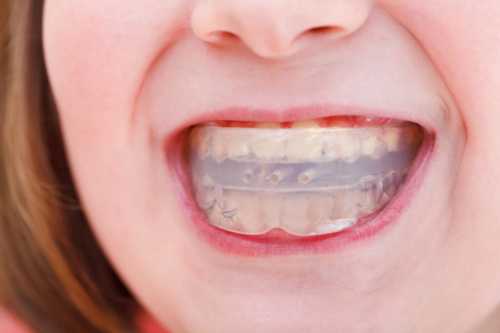 Charles E. Boren | Mouth Guard for Teeth Grinding Mouth Guard Implant for Teeth Grinding
