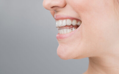 Blog 8 Best Dentist Near Me Bunker Hill Village TX