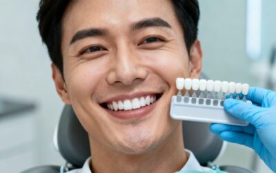 Blog 6 Best Professional Teeth Whitening in Bellaire, TX