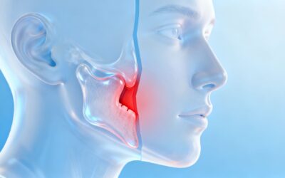 Blog 9 What Causes TMJ Disorder? A Bellaire, TX Dentist Explains