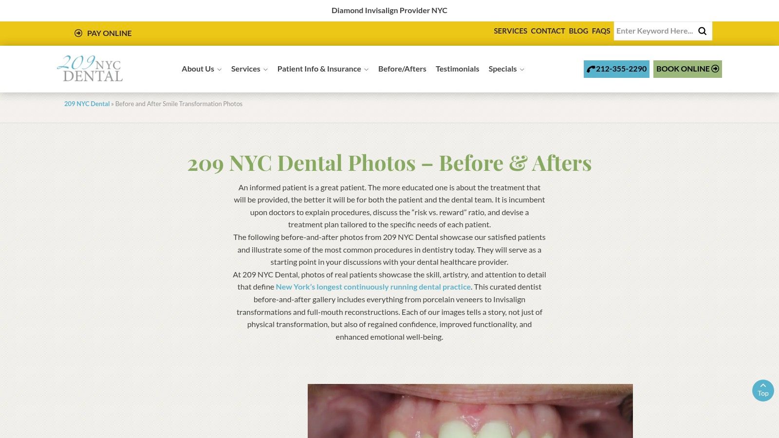 Stunning Cosmetic Dentistry Before and After 5 209 NYC Dental (New York, NY)