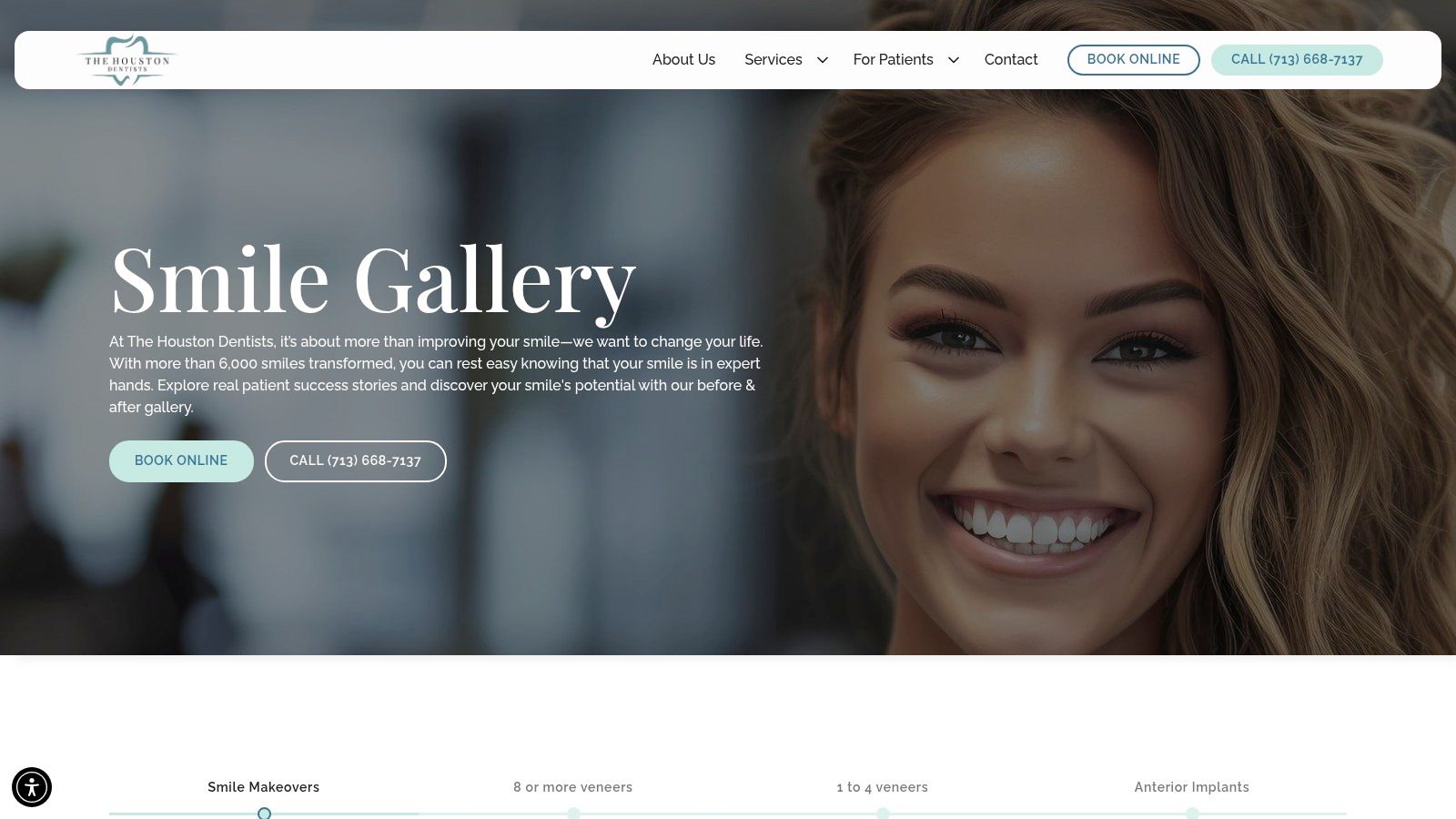 Stunning Cosmetic Dentistry Before and After 6 The Houston Dentists (Houston / Bellaire, TX)