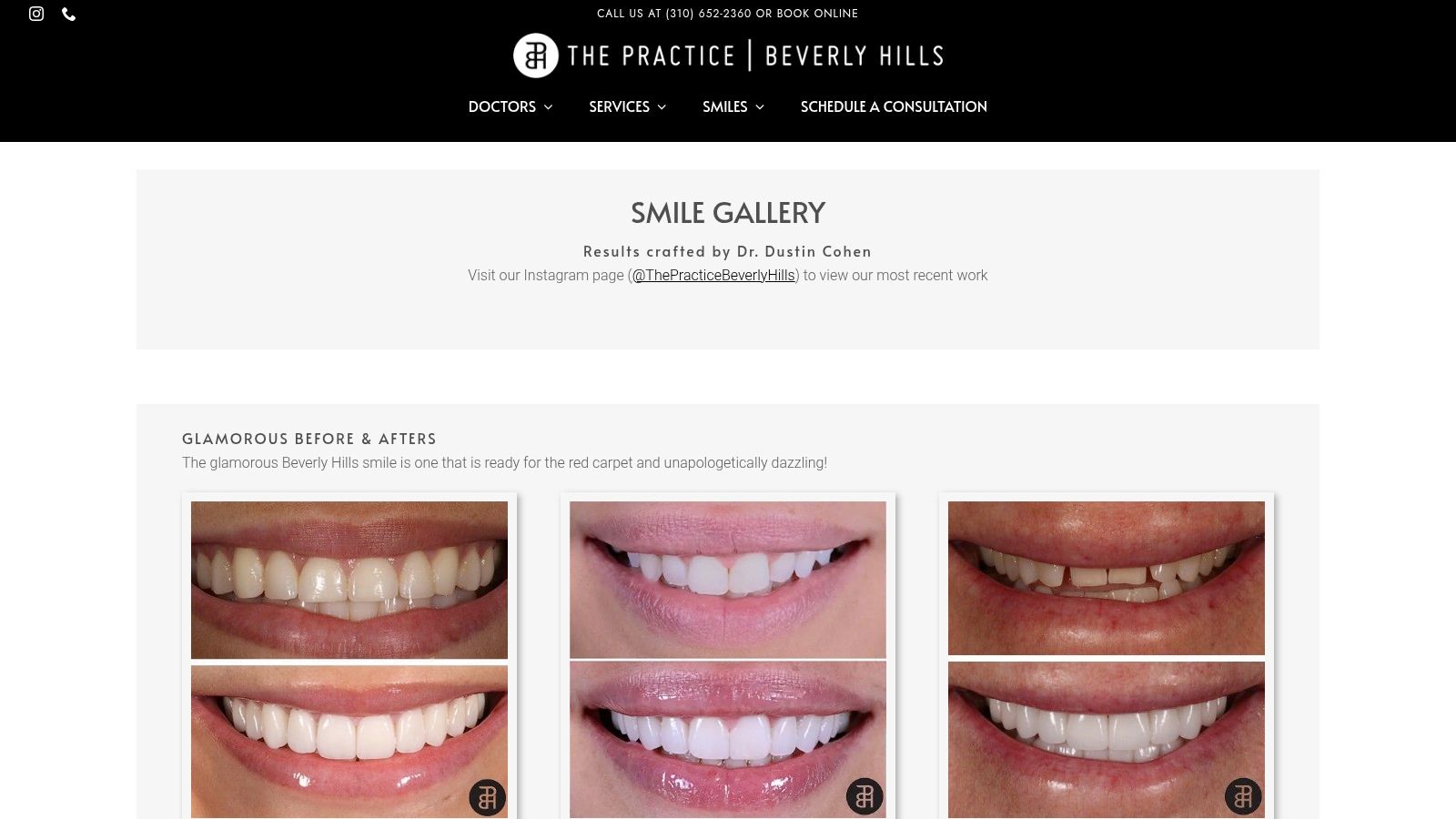 Stunning Cosmetic Dentistry Before and After 4 The Practice | Beverly Hills Boutique Dental (Beverly Hills, CA)