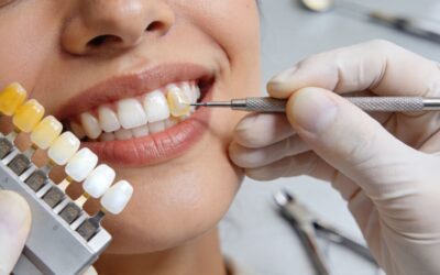 Blog 7 Achieve Your Best Smile: Teeth Whitening Bonding