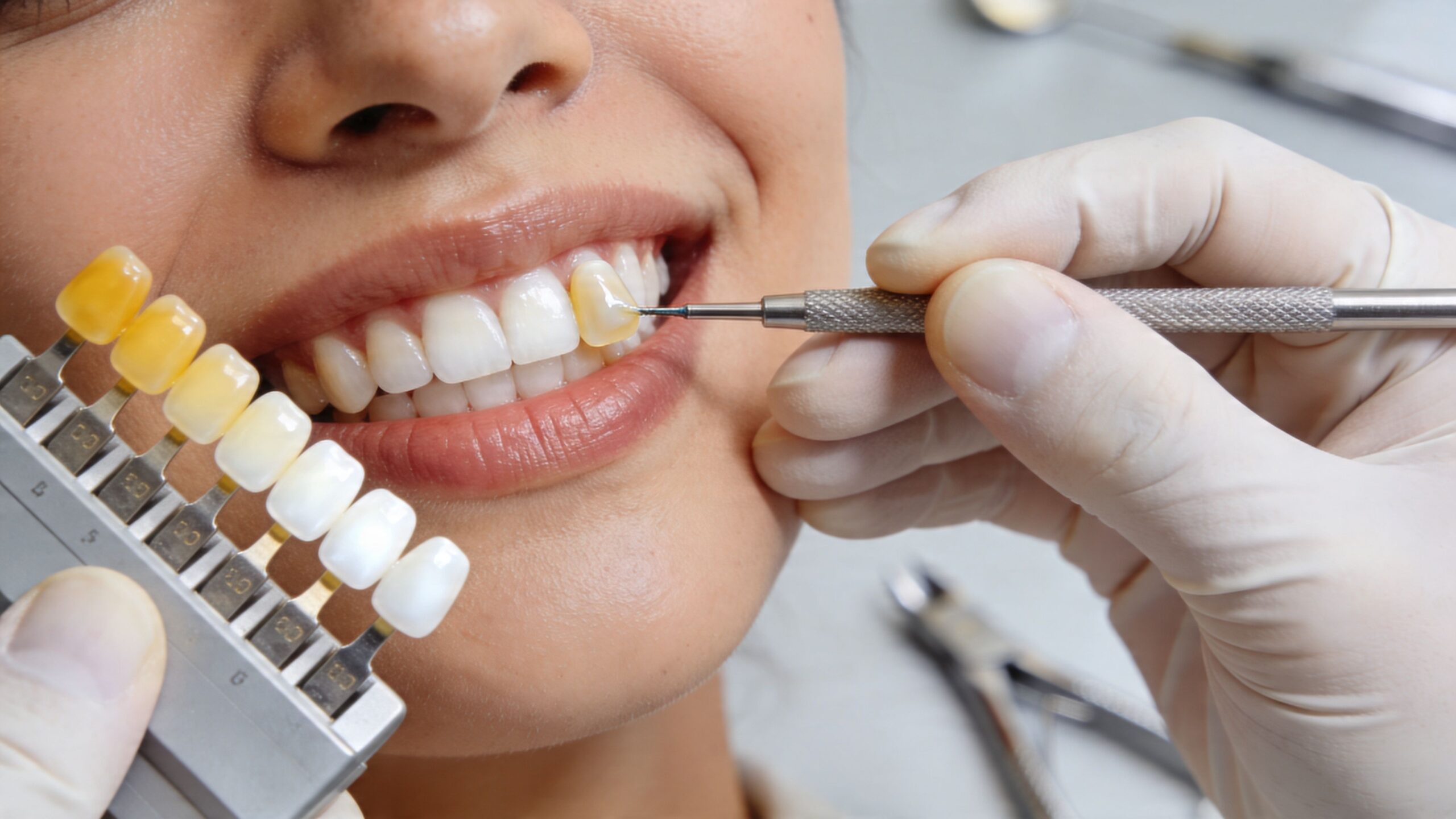 Charles E. Boren | Achieve Your Best Smile: Teeth Whitening Bonding